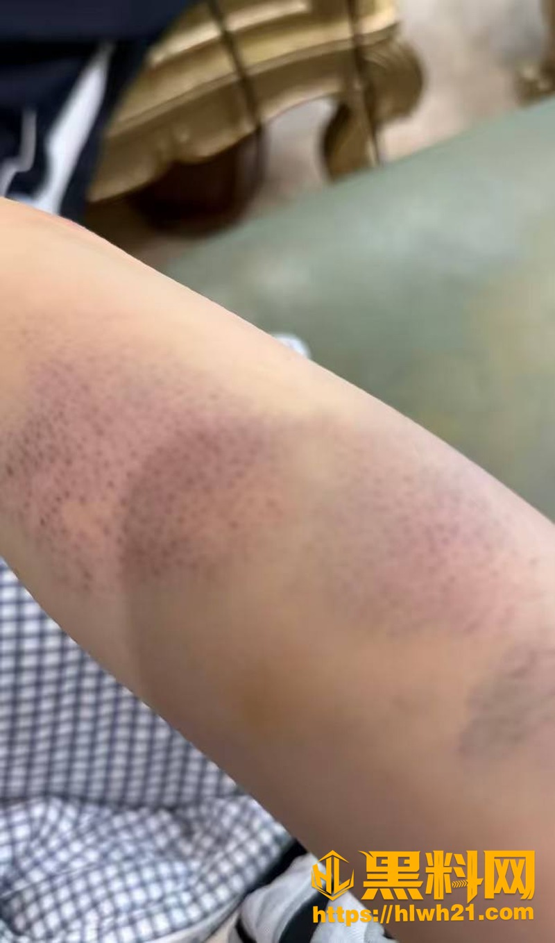 黄檬檬500元补偿争议后续 3