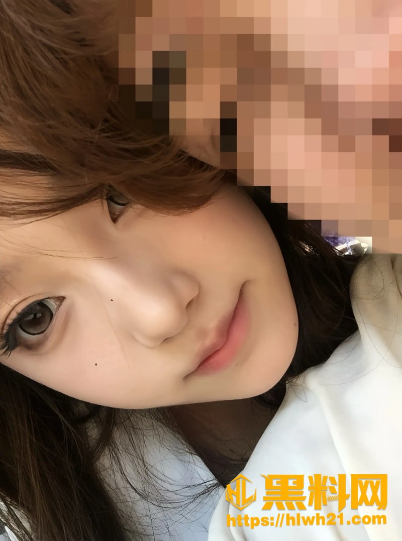 黄檬檬晒病历与照片事件 7