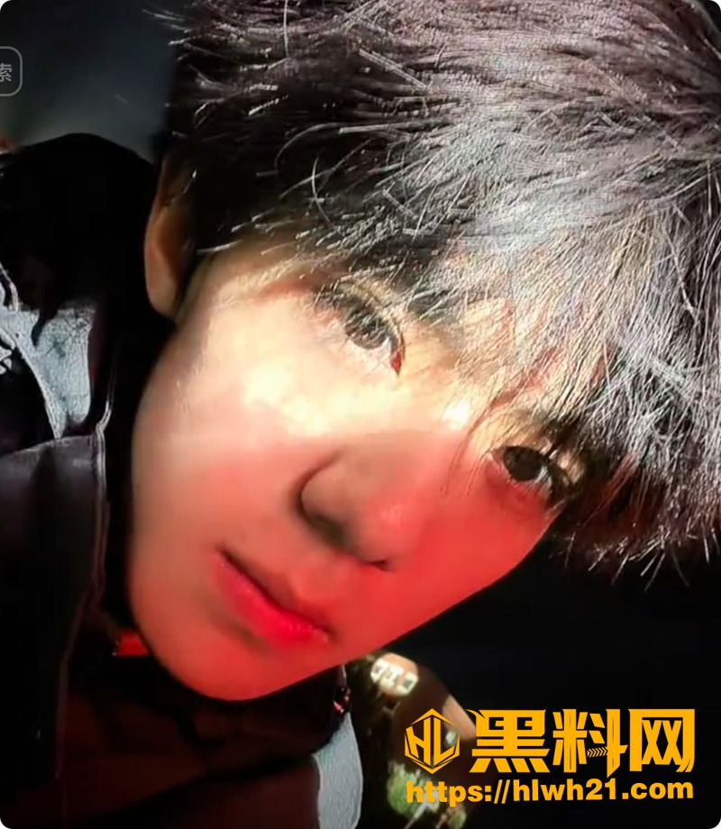 黄檬檬晒病历与照片事件 1